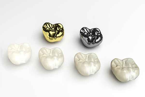 porcelain-crowns-gold-crowns